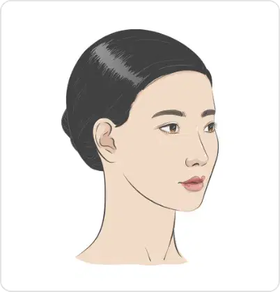 측면 사진